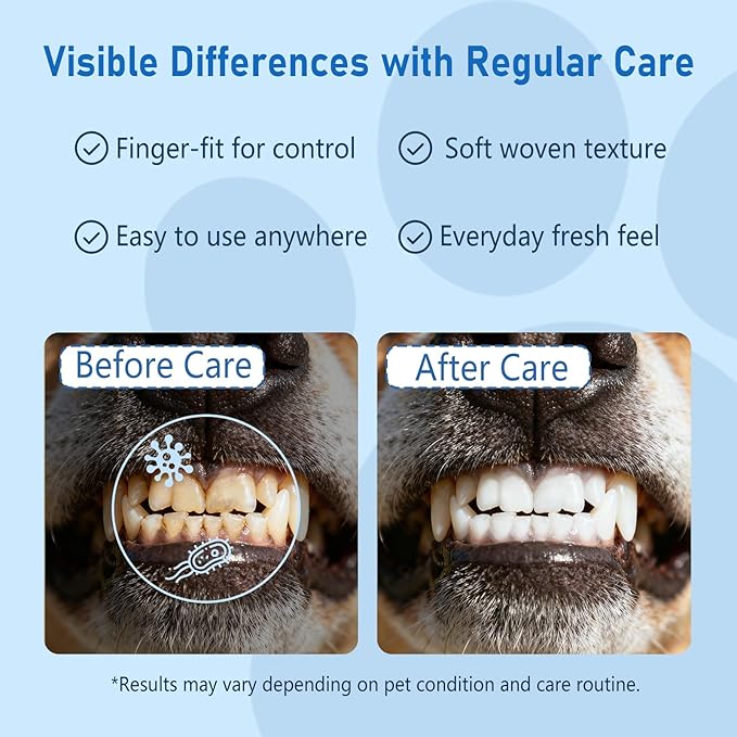 GIFTMISSU 80 Counts Pet Dental Finger Wipes for Dogs and Cats - Disposable Dog Teeth Cleaning Wipes for No-Rinse Daily Oral Care, Pet Tooth Cleaning Wipes